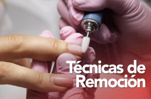 Técnicas de Remoción